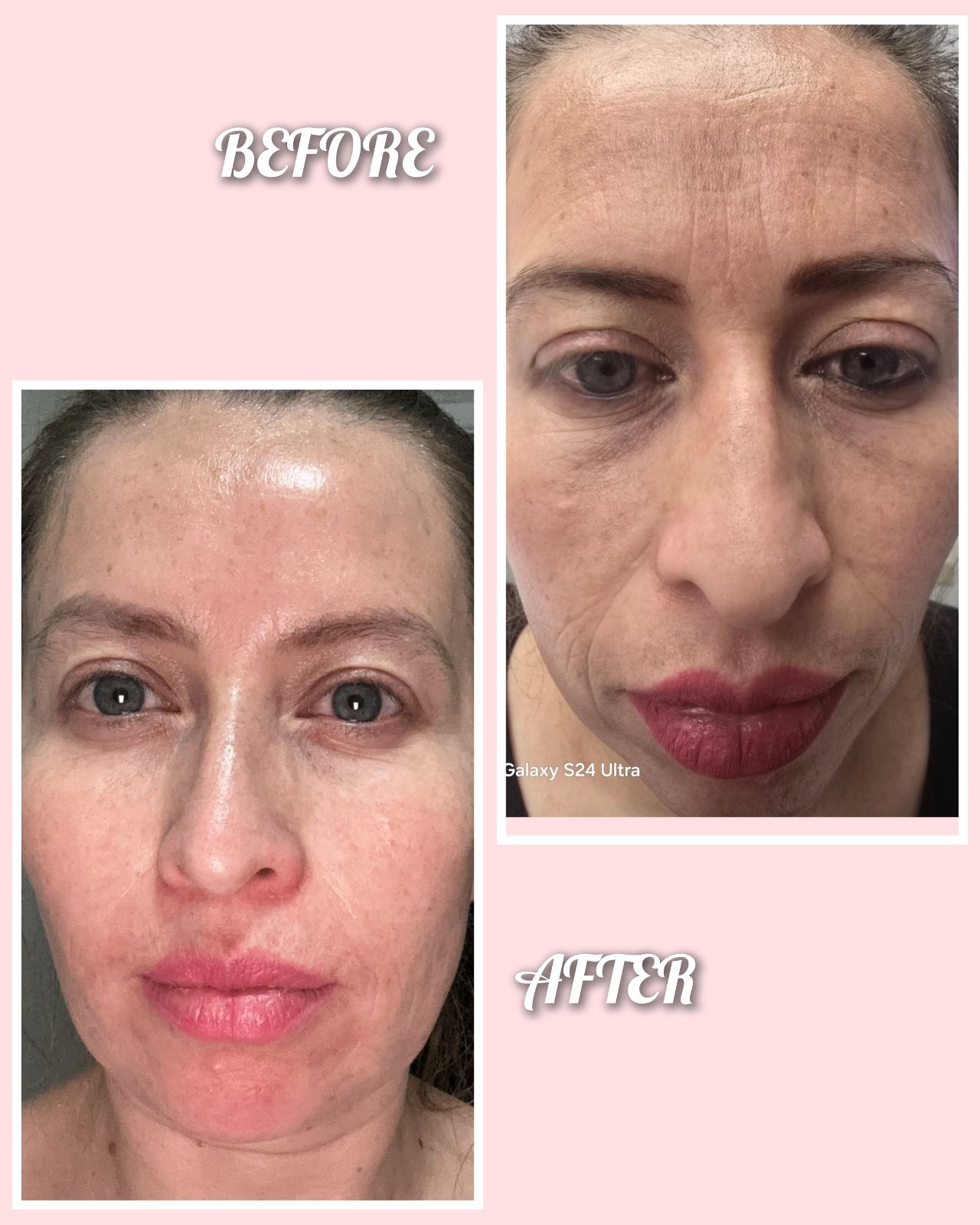 A natural glow before-and-after photographs supplied by Varua Spa