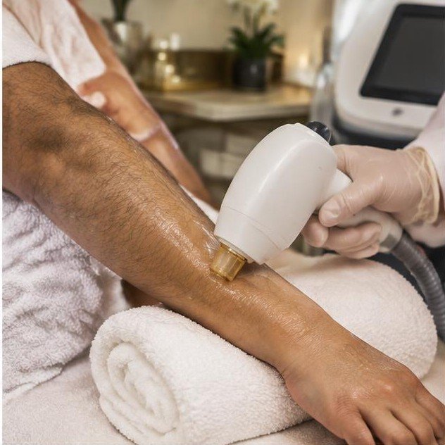 Medium Area Laser Hair Removal (6 Sessions) — illustrative spa treatment photograph