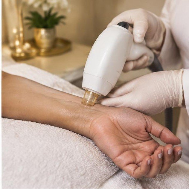 Small Area Laser Hair Removal (6 Sessions) — illustrative spa treatment photograph