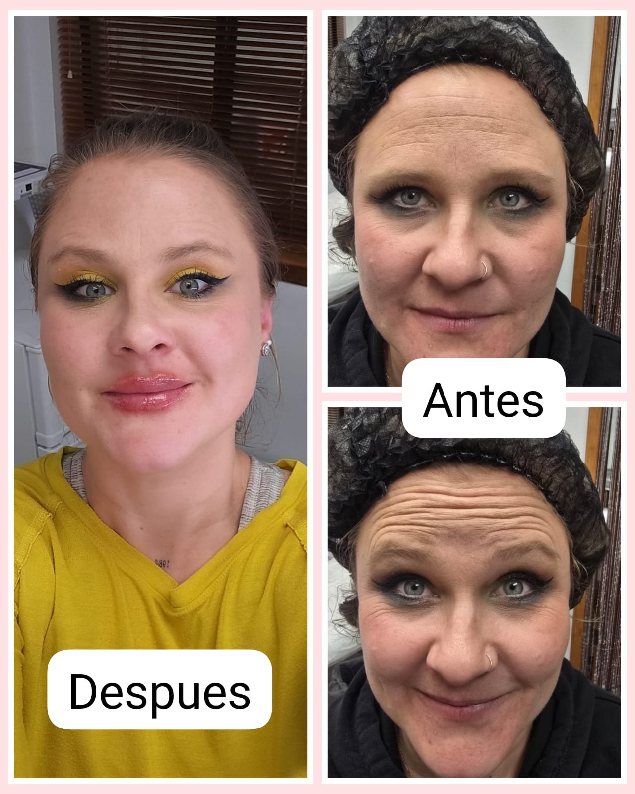 A refreshed complexion before-and-after photographs supplied by Varua Spa